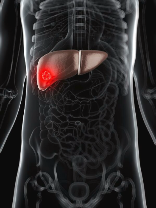 �������� � ������ ����-���������: ����.